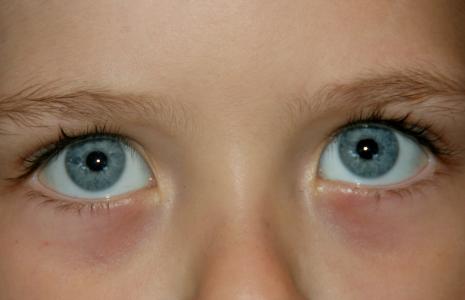 眼睛, 蓝色, 基因